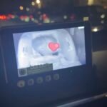 Baby Car Camera & Monitor System 1440P photo review